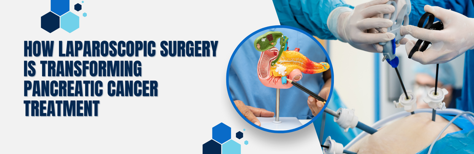 Laparoscopic Surgery