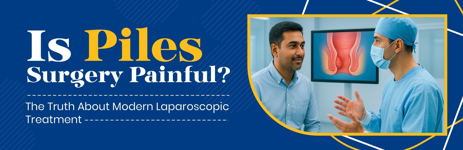 Piles Surgery Laparoscopic Treatment