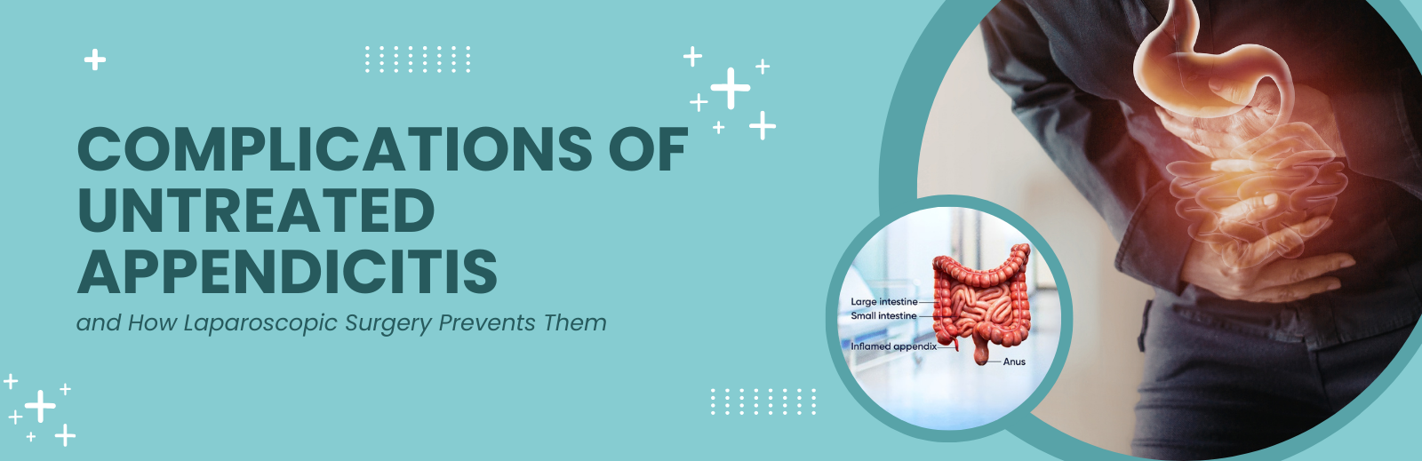 Laparoscopic Surgery for Appendicitis