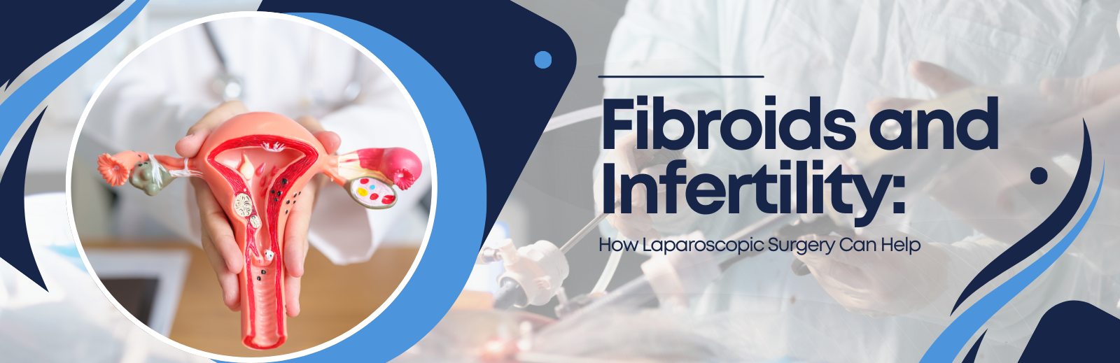 Laparoscopic Surgery for Fibroids