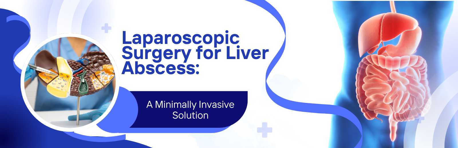 Laparoscopic Surgery for Liver Abscess