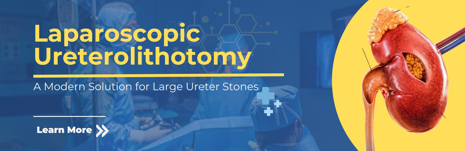 Laparoscopic Ureterolithotomy