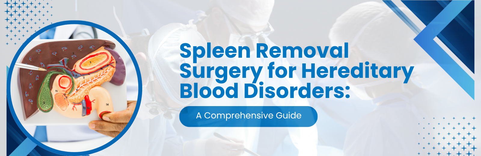 Laparoscopic Splenectomy