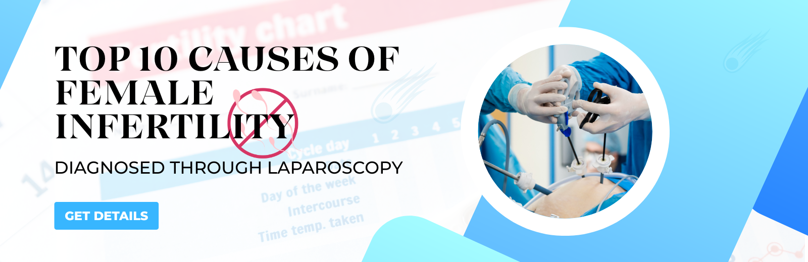 Laparoscopy for Infertility